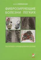 Фиброзирующие болезни легких. Роль рентгенолога в мультидисциплинарном консилиуме